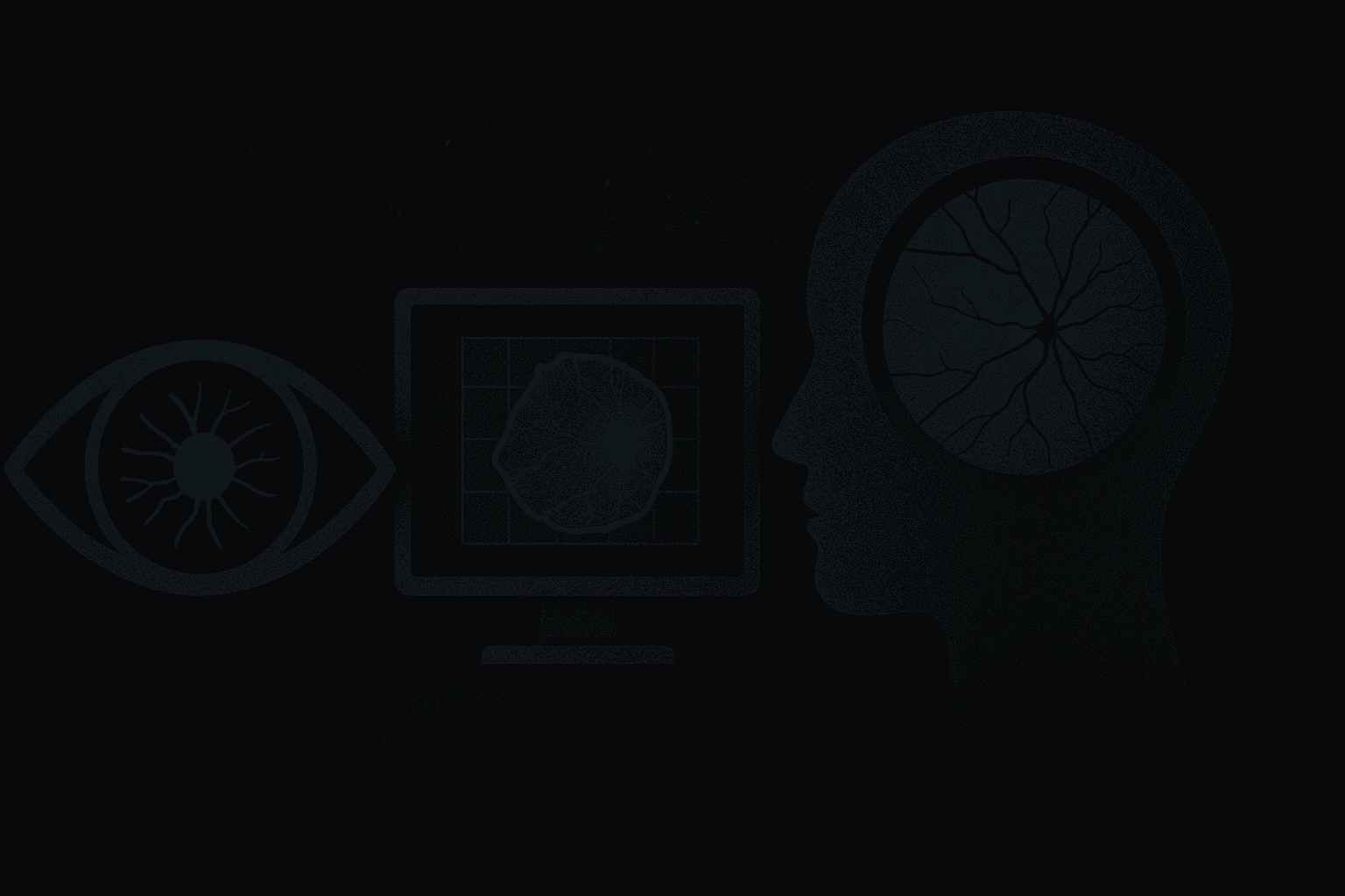 Glaucoma Detection System